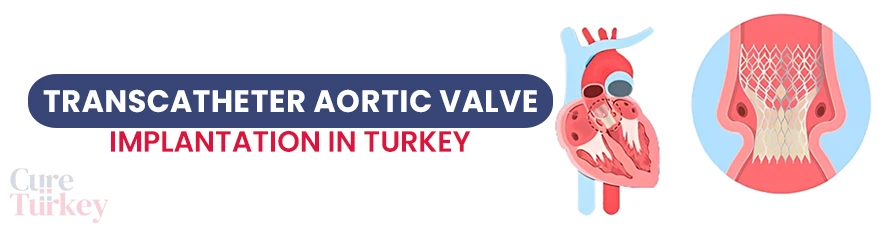 Transcatheter Aortic Valve Implantation (TAVI)